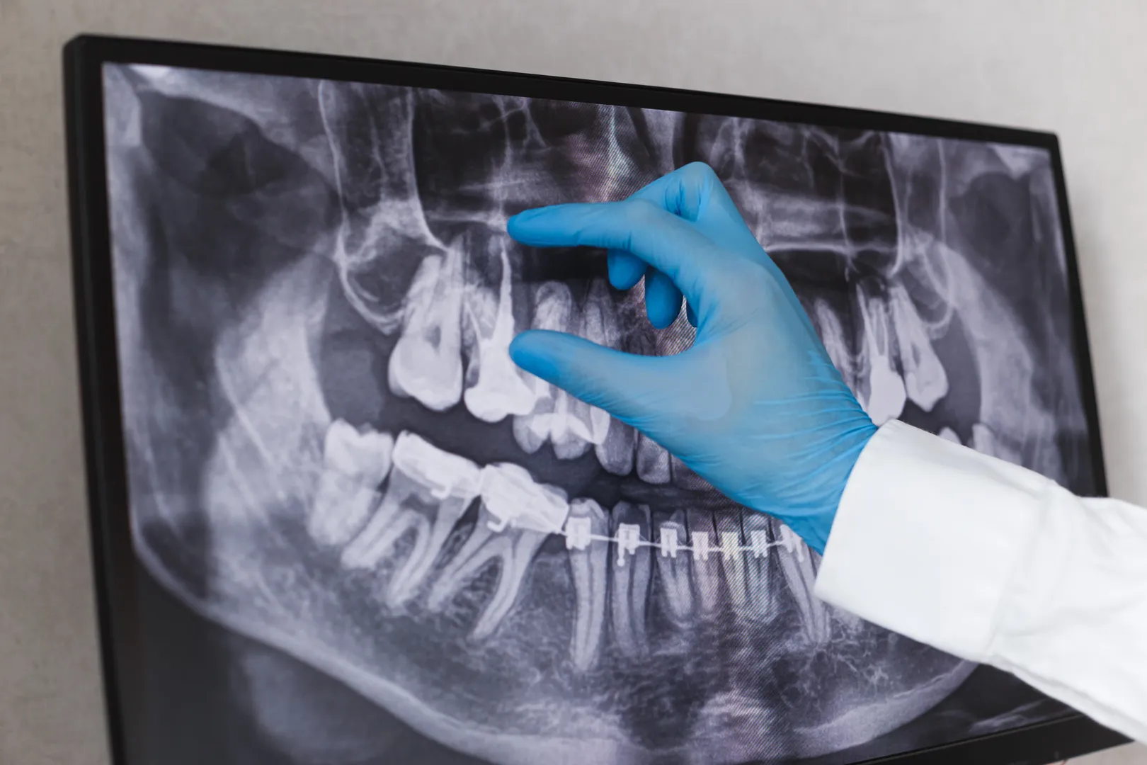 Digital X-Rays