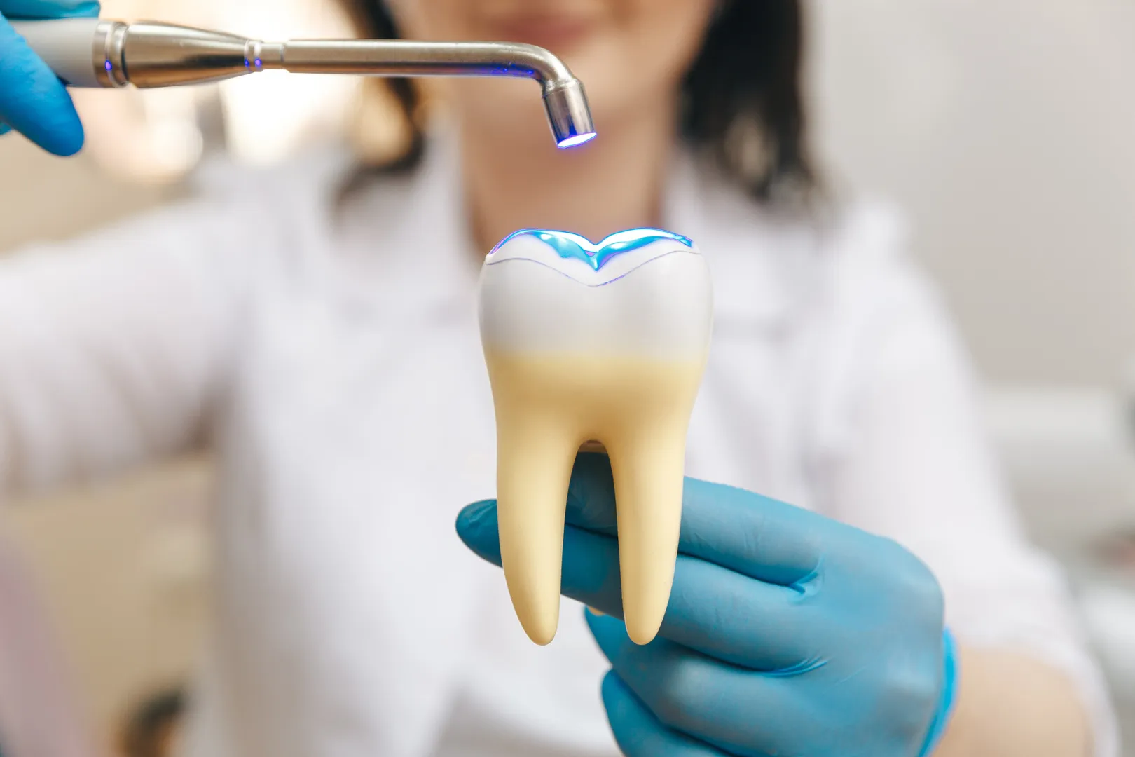 Composite Fillings