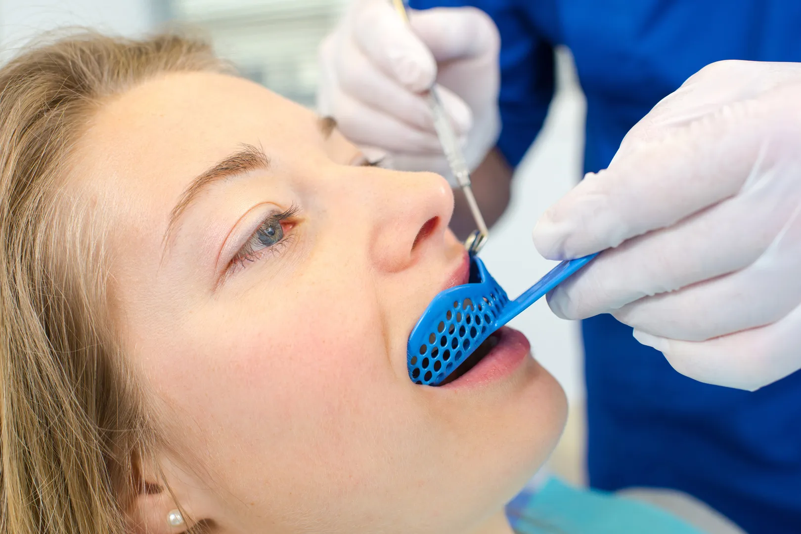 Caring for Athletic Mouth Guards