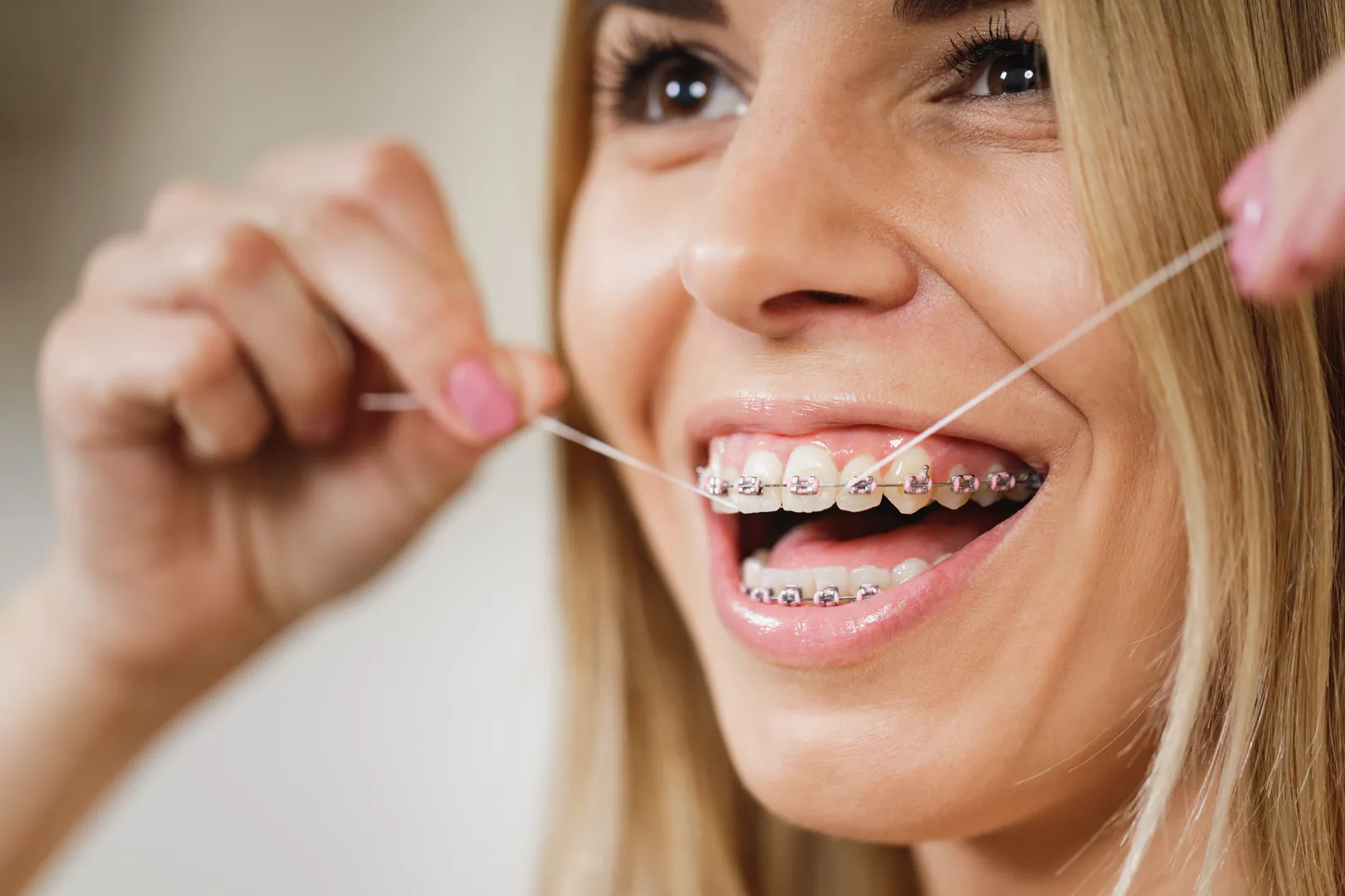 Brushing and Flossing with Braces